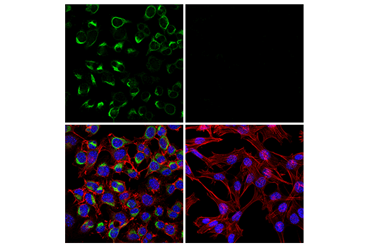 Immunofluorescence Image 2: Neurofilament-H Antibody