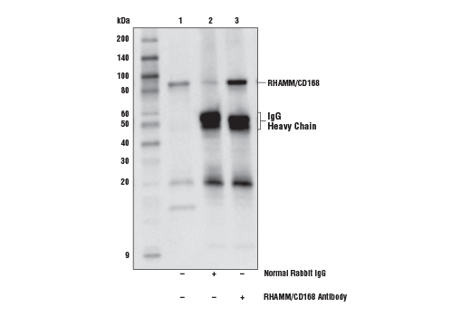 Immunoprecipitation Image 1: RHAMM/CD168 Antibody