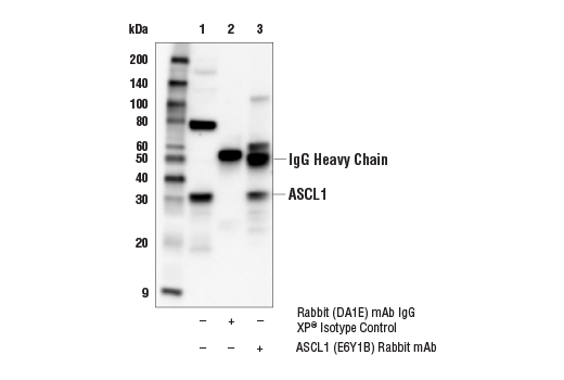 Immunoprecipitation Image 1: ASCL1 (E6Y1B) Rabbit mAb