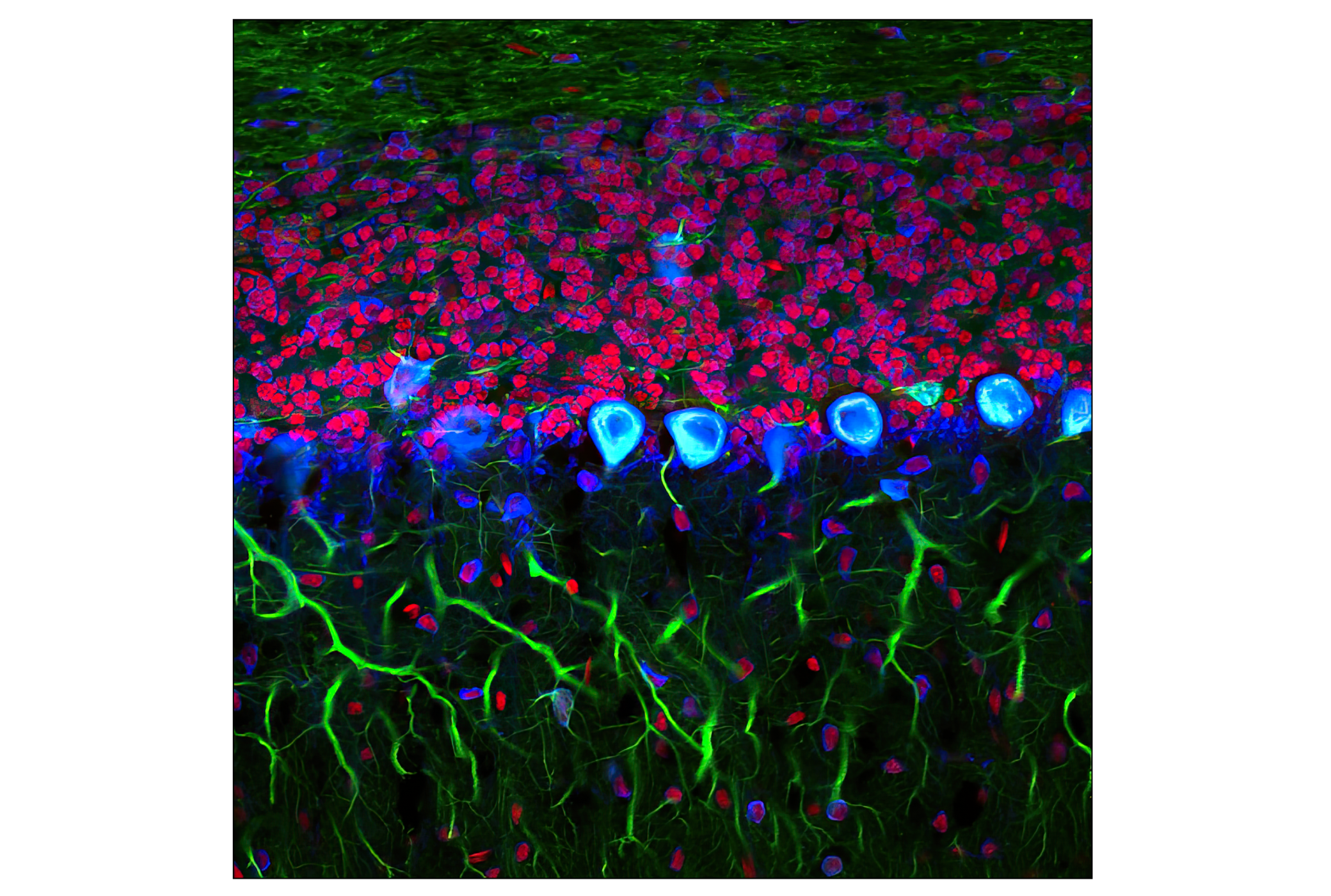 Immunofluorescence Image 1: S6 Ribosomal Protein (54D2) Mouse mAb (Alexa Fluor® 647 Conjugate)