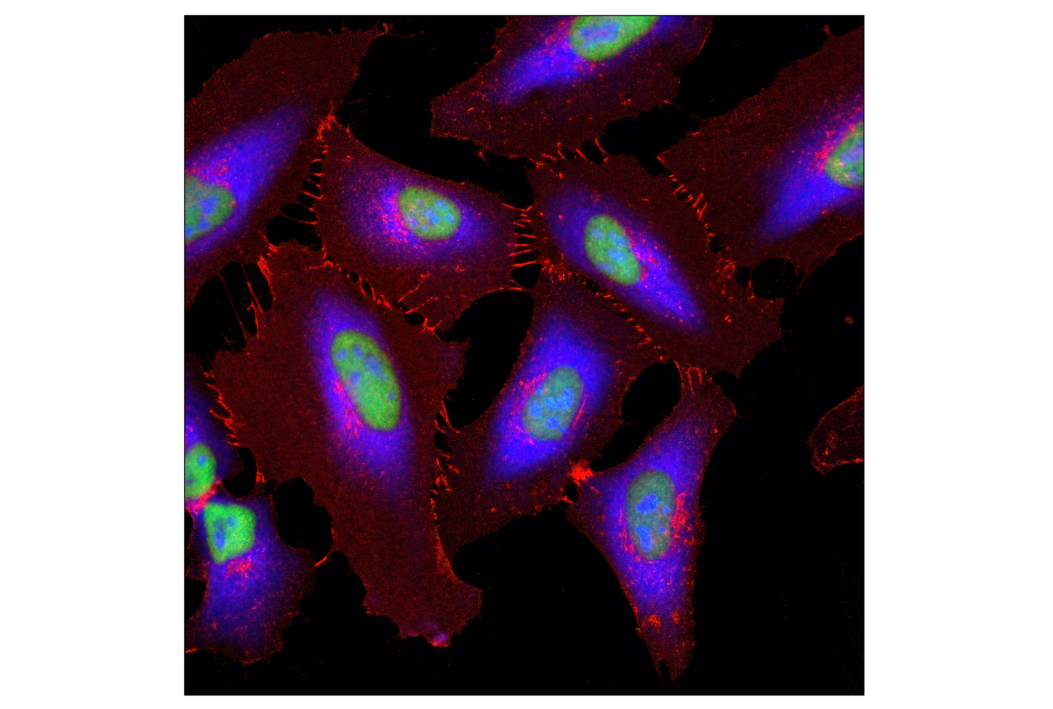 Immunofluorescence Image 2: S6 Ribosomal Protein (54D2) Mouse mAb (Alexa Fluor® 647 Conjugate)