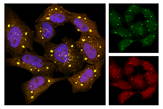 Immunofluorescence Image 1: GFP (5G4) Mouse mAb