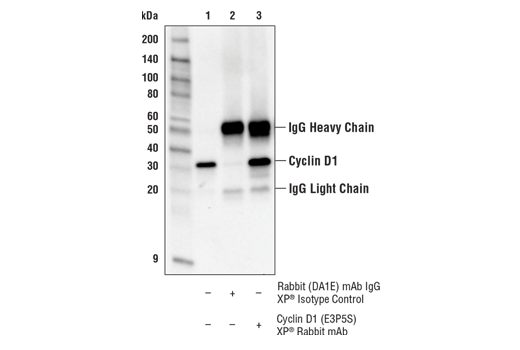 Immunoprecipitation Image 1: Cyclin D1 (E3P5S) XP® Rabbit mAb