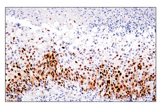 Immunohistochemistry Image 2: Cyclin D1 (E3P5S) XP® Rabbit mAb