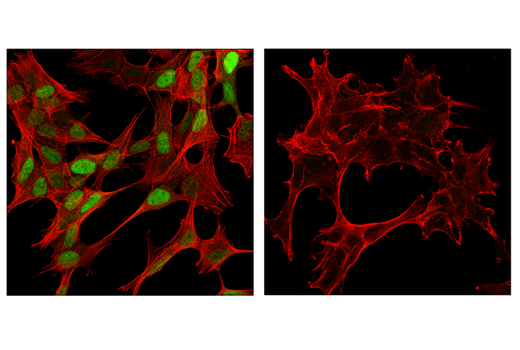 Immunofluorescence Image 1: Cyclin D1 (E3P5S) XP® Rabbit mAb