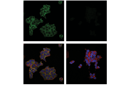 Immunofluorescence Image 1: PLCγ2 (E5U4T) Rabbit mAb
