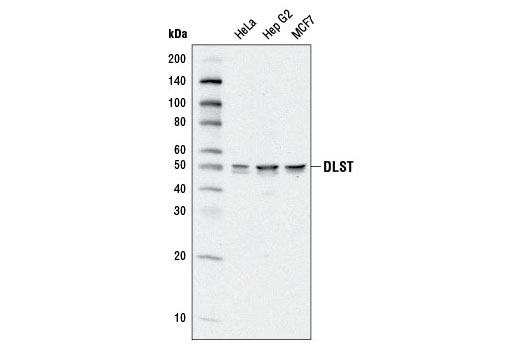 Western Blotting Image 1: DLST Antibody