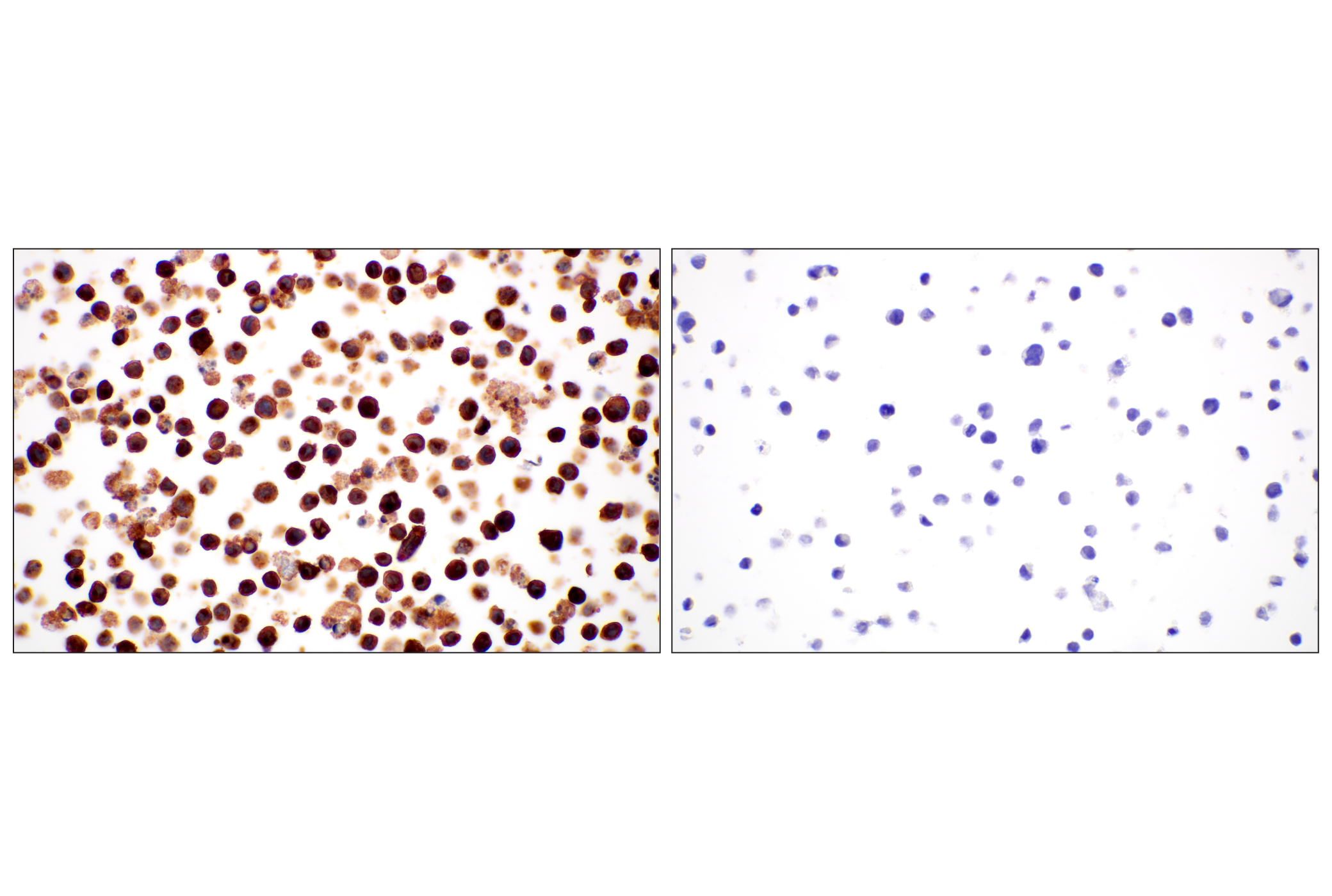 Immunohistochemistry Image 9: CD93/C1qR (E5H9B) Rabbit mAb (BSA and Azide Free)