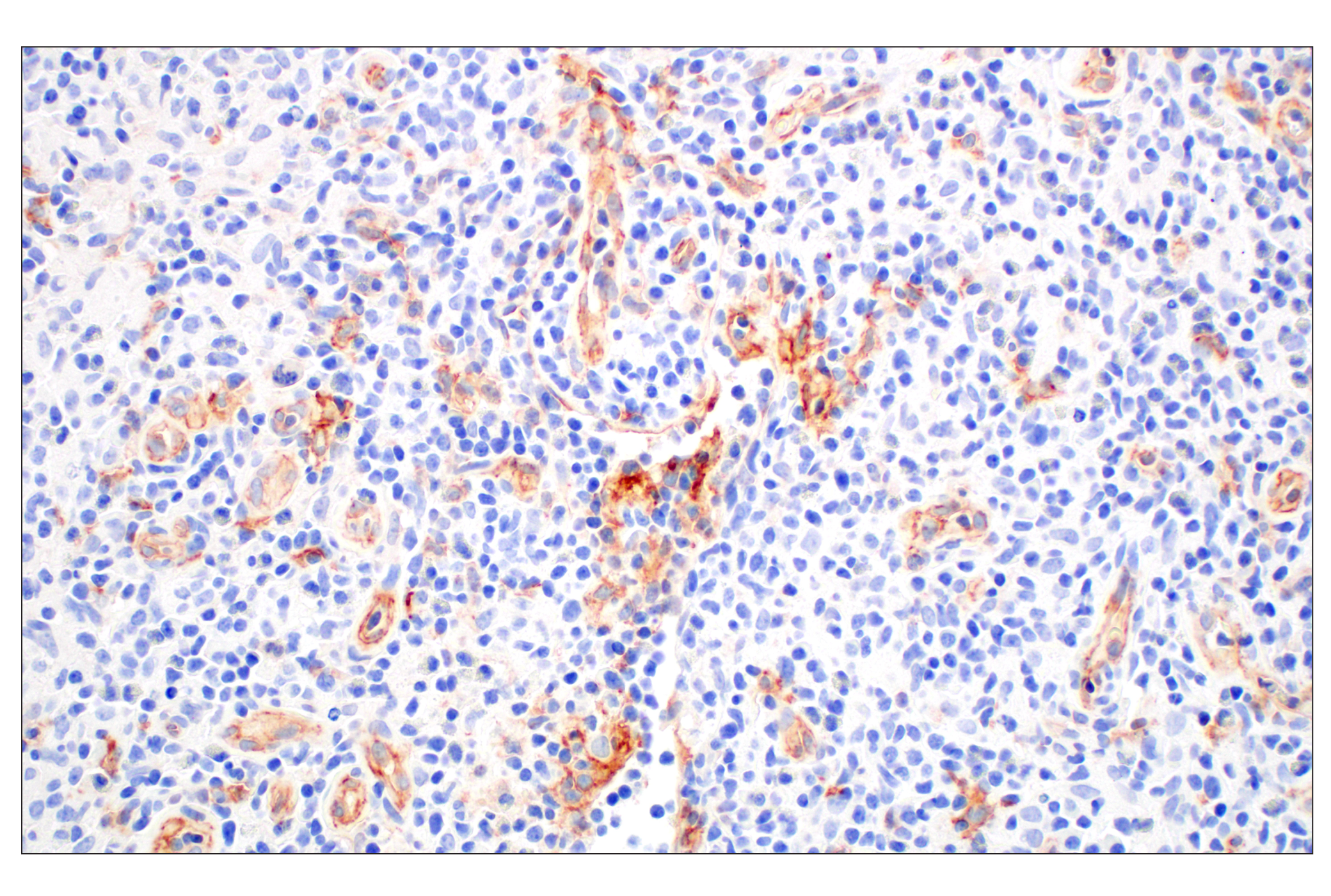 Immunohistochemistry Image 1: CD93/C1qR (E5H9B) Rabbit mAb (BSA and Azide Free)