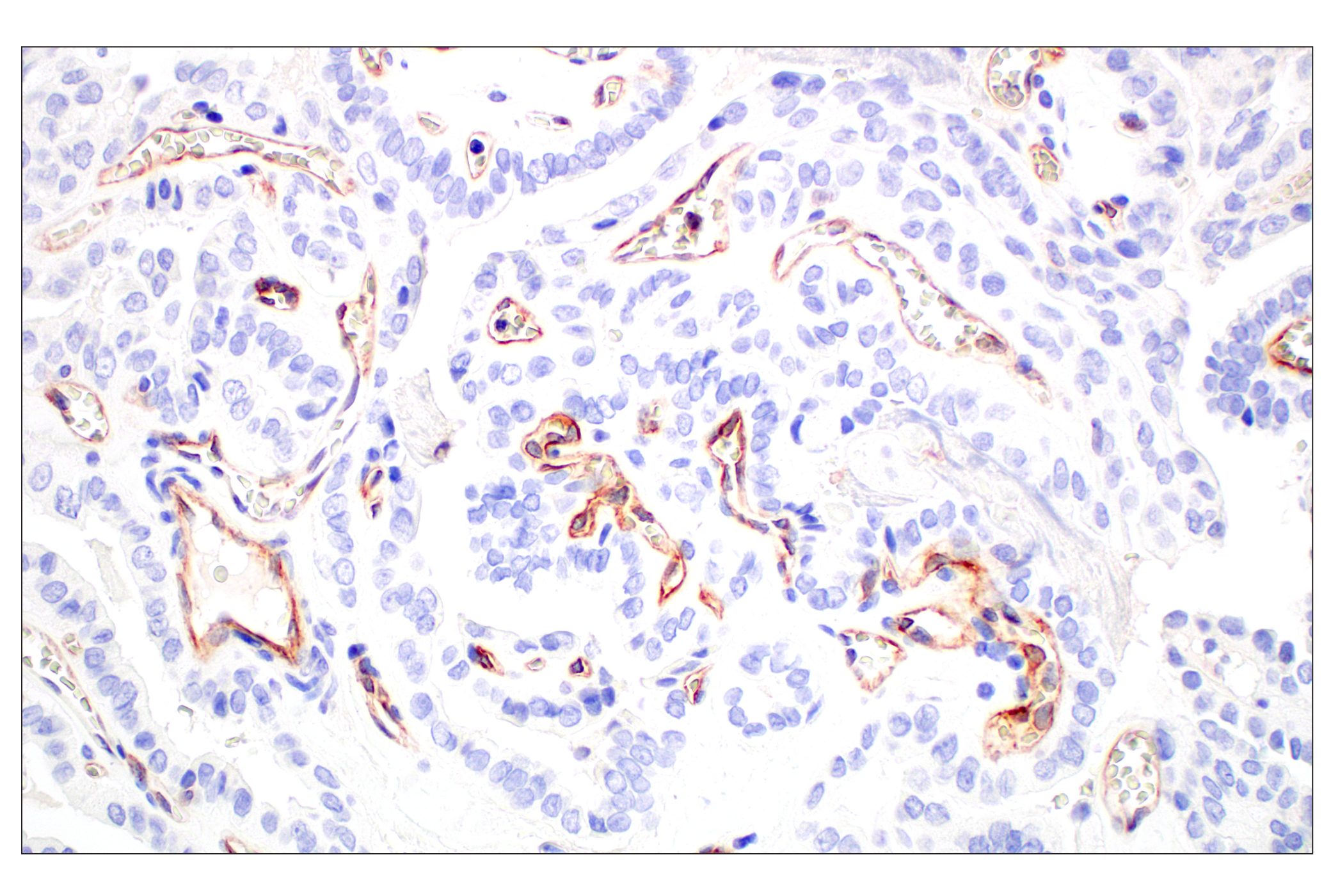 Immunohistochemistry Image 3: CD93/C1qR (E5H9B) Rabbit mAb (BSA and Azide Free)
