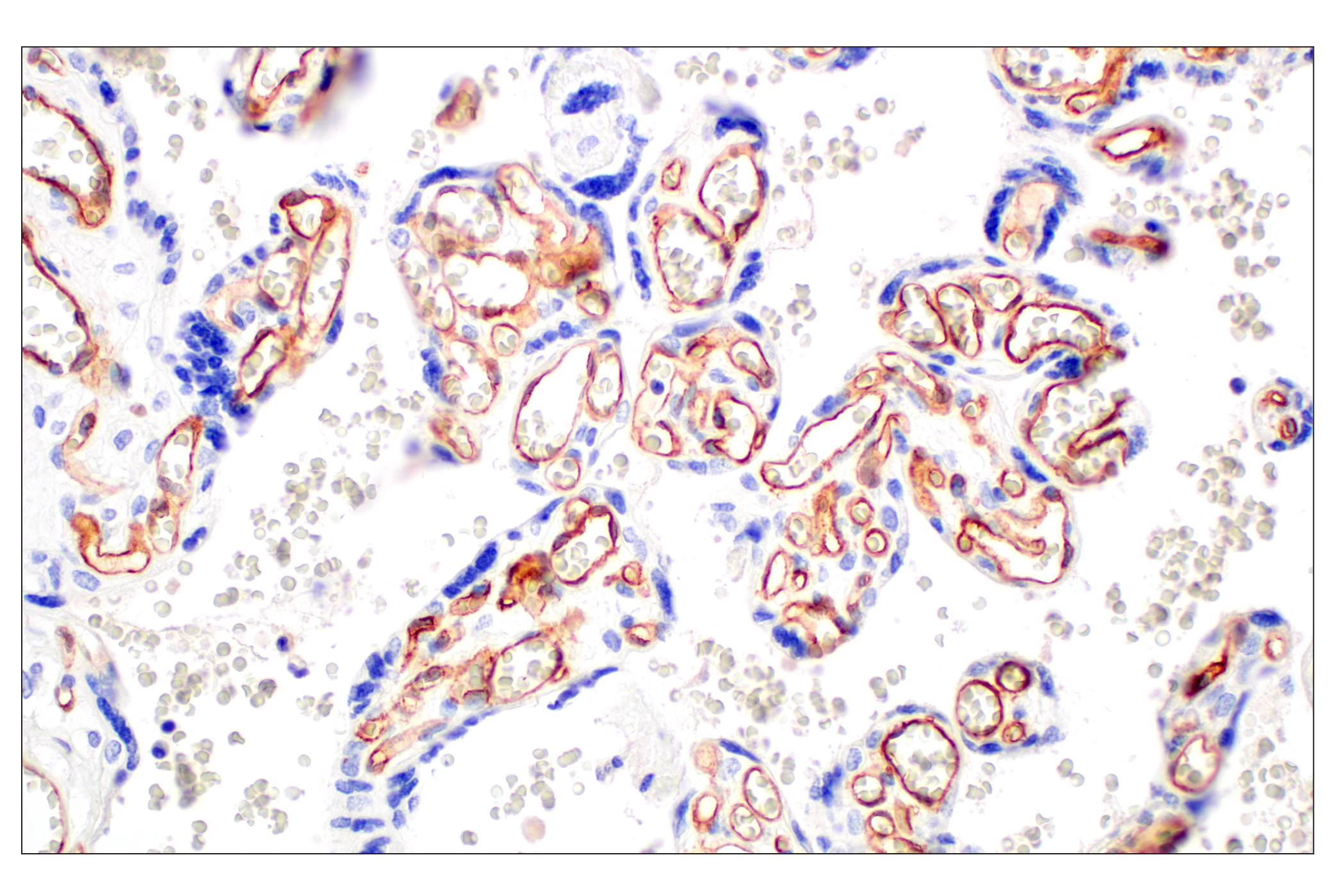 Immunohistochemistry Image 5: CD93/C1qR (E5H9B) Rabbit mAb (BSA and Azide Free)