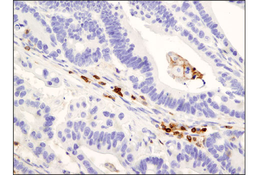 Immunohistochemistry Image 1: CD45RO (UCHL1) Mouse mAb (IHC Specific)