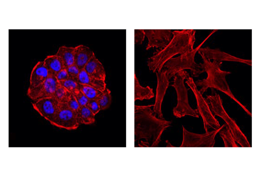 Immunofluorescence Image 1: Progesterone Receptor A/B (D8Q2J) XP® Rabbit mAb (Alexa Fluor® 647 Conjugate)