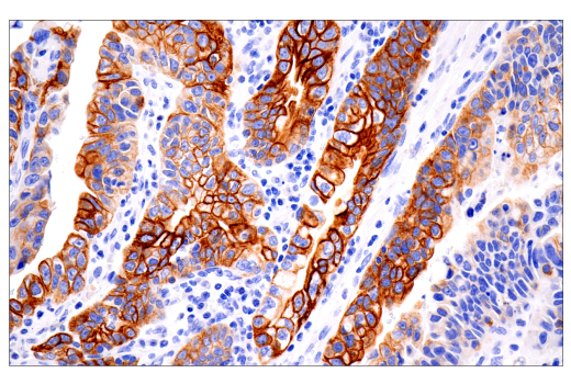 Immunohistochemistry Image 3: Keratin 7 (RN7) Mouse mAb