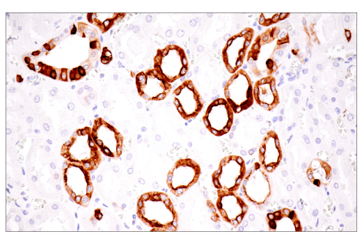 Immunohistochemistry Image 12: Keratin 7 (RN7) Mouse mAb