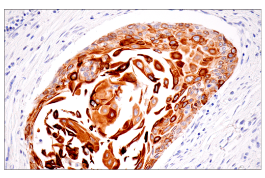 Immunohistochemistry Image 5: Keratin 7 (RN7) Mouse mAb
