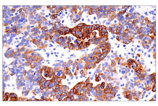 Immunohistochemistry Image 1: Keratin 7 (RN7) Mouse mAb