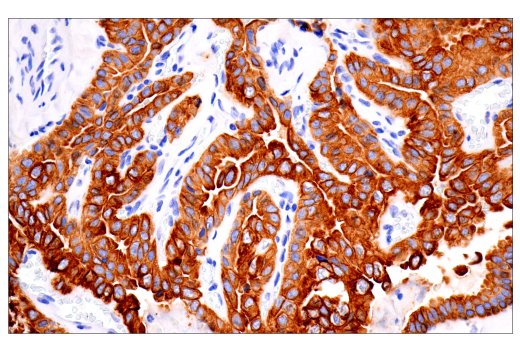 Immunohistochemistry Image 2: Keratin 7 (RN7) Mouse mAb