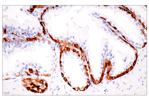 Immunohistochemistry Image 11: Keratin 7 (RN7) Mouse mAb