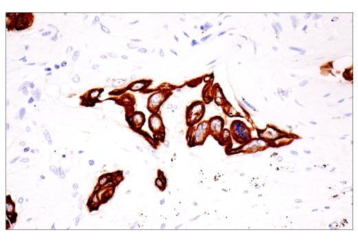Immunohistochemistry Image 6: Keratin 7 (RN7) Mouse mAb