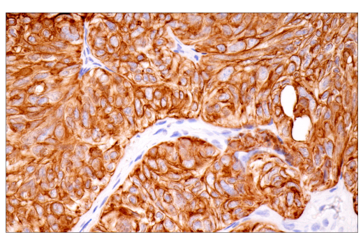 Immunohistochemistry Image 7: Keratin 7 (RN7) Mouse mAb