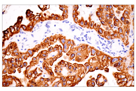 Immunohistochemistry Image 8: Keratin 7 (RN7) Mouse mAb