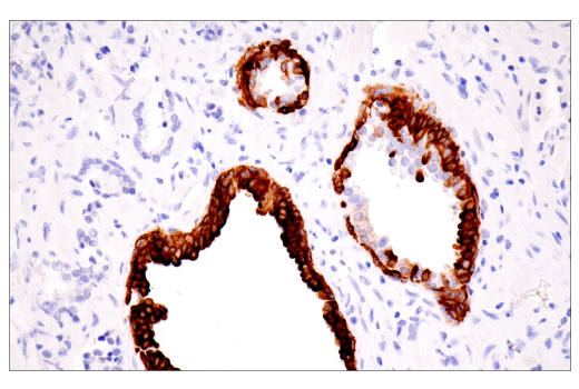 Immunohistochemistry Image 9: Keratin 7 (RN7) Mouse mAb