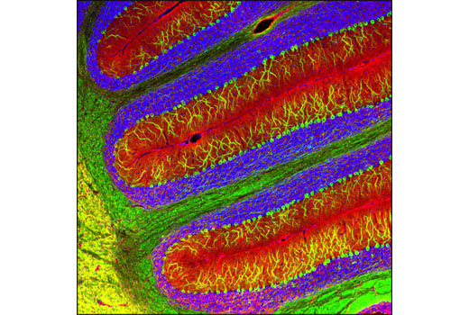  Image 15: Mature Neuron Marker Antibody Sampler Kit