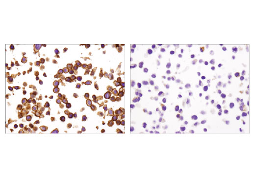 Immunohistochemistry Image 4: EpCAM (D9S3P) Rabbit mAb (IHC Preferred) (BSA and Azide Free)