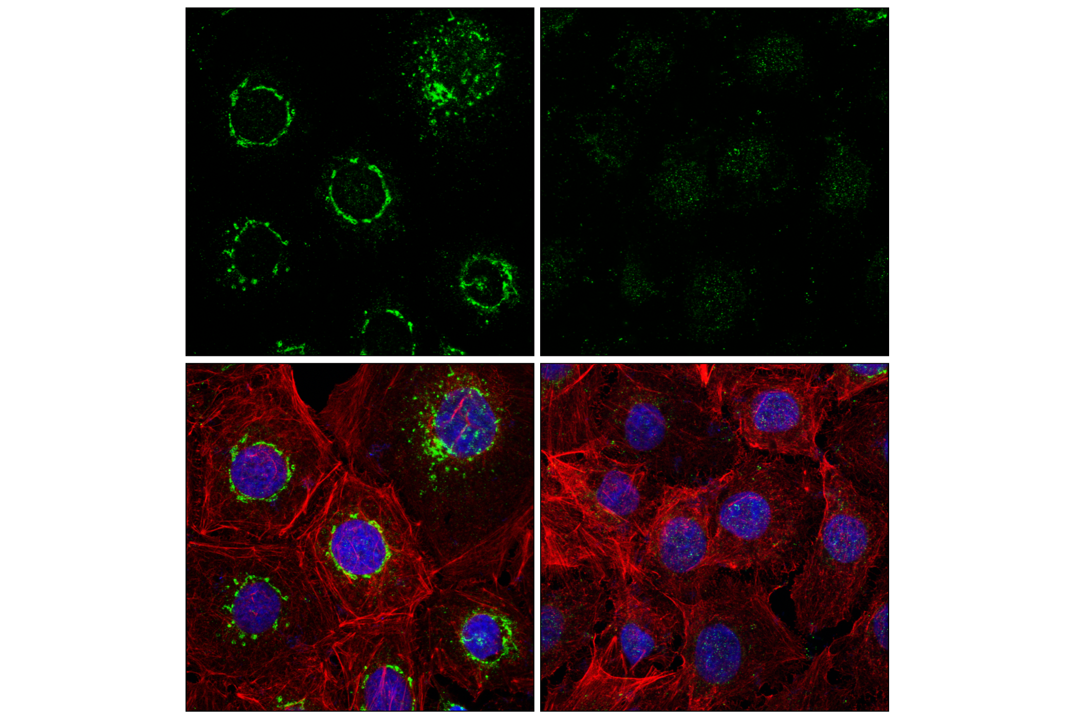 Immunofluorescence Image 1: TGOLN2/TGN38 (E7W1N) Rabbit mAb