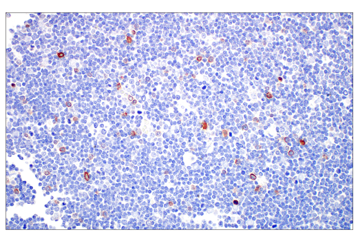 Immunohistochemistry Image 3: TRDC/TCRδ (E2E9T) XP® Rabbit mAb