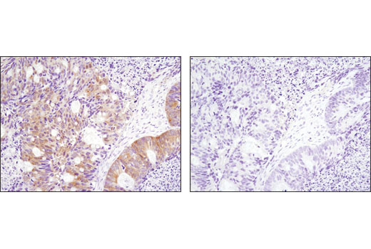 Immunohistochemistry Image 1: Phospho-p90RSK (Thr359) (D1E9) Rabbit mAb (BSA and Azide Free)