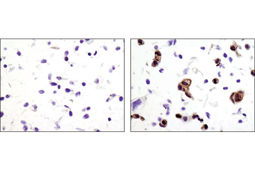 Immunohistochemistry Image 3: Phospho-p90RSK (Thr359) (D1E9) Rabbit mAb (BSA and Azide Free)