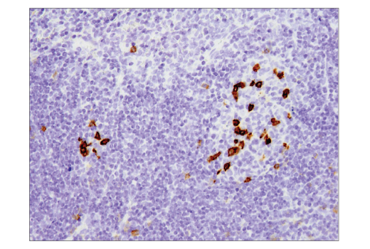 Immunohistochemistry Image 4: PD-1 (D7D5W) XP® Rabbit mAb (Mouse Specific) (BSA and Azide Free)