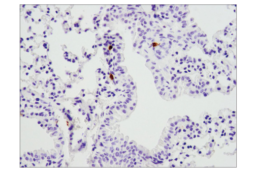 Immunohistochemistry Image 4: PD-1 (D7D5W) XP® Rabbit mAb (Mouse Specific) (BSA and Azide Free)