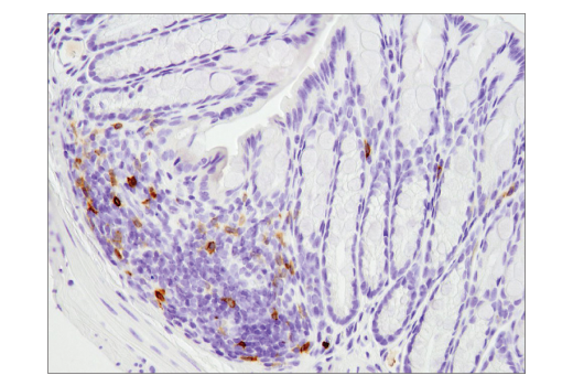 Immunohistochemistry Image 2: PD-1 (D7D5W) XP® Rabbit mAb (Mouse Specific) (BSA and Azide Free)