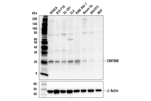 Western Blotting Image 1: CMTM6 Antibody