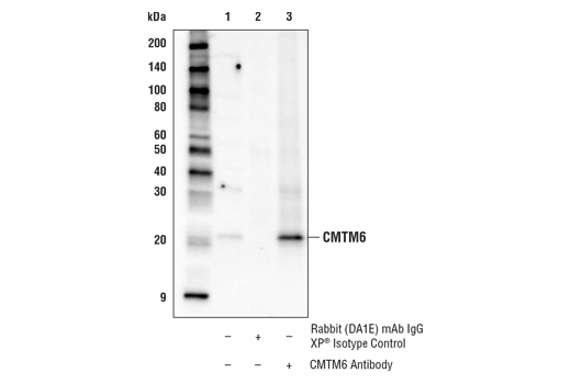 Immunoprecipitation Image 1: CMTM6 Antibody
