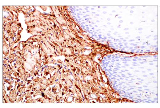 Immunohistochemistry Image 11: Decorin (E2N2C) XP® Rabbit mAb (BSA and Azide Free)