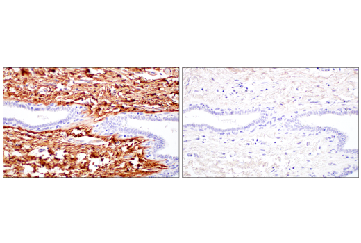 Immunohistochemistry Image 12: Decorin (E2N2C) XP® Rabbit mAb (BSA and Azide Free)