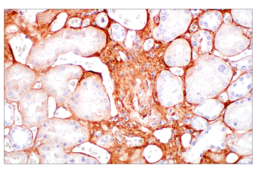 Immunohistochemistry Image 8: Decorin (E2N2C) XP® Rabbit mAb (BSA and Azide Free)