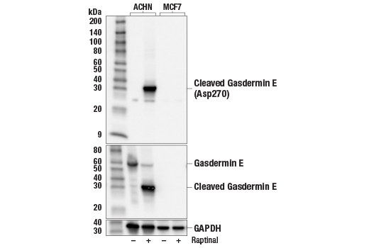  Image 3: Gasdermin Family Antibody Sampler Kit