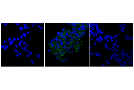 Immunofluorescence Image 1: Cleaved Gasdermin E (Asp270) (E8G4U) Rabbit mAb