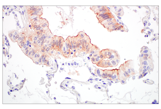 Immunohistochemistry Image 5: Villin-1 (CWWB1) Mouse mAb