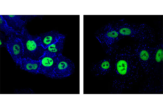 Immunofluorescence Image 1: EGF Receptor (D38B1) XP® Rabbit mAb (Alexa Fluor® 647 Conjugate)