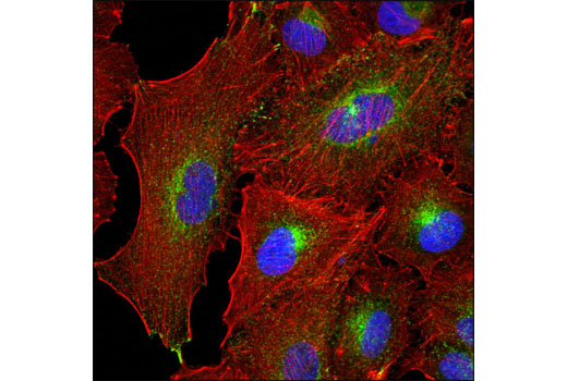  Image 21: LRP1-mediated Endocytosis and Transmission of Tau Antibody Sampler Kit