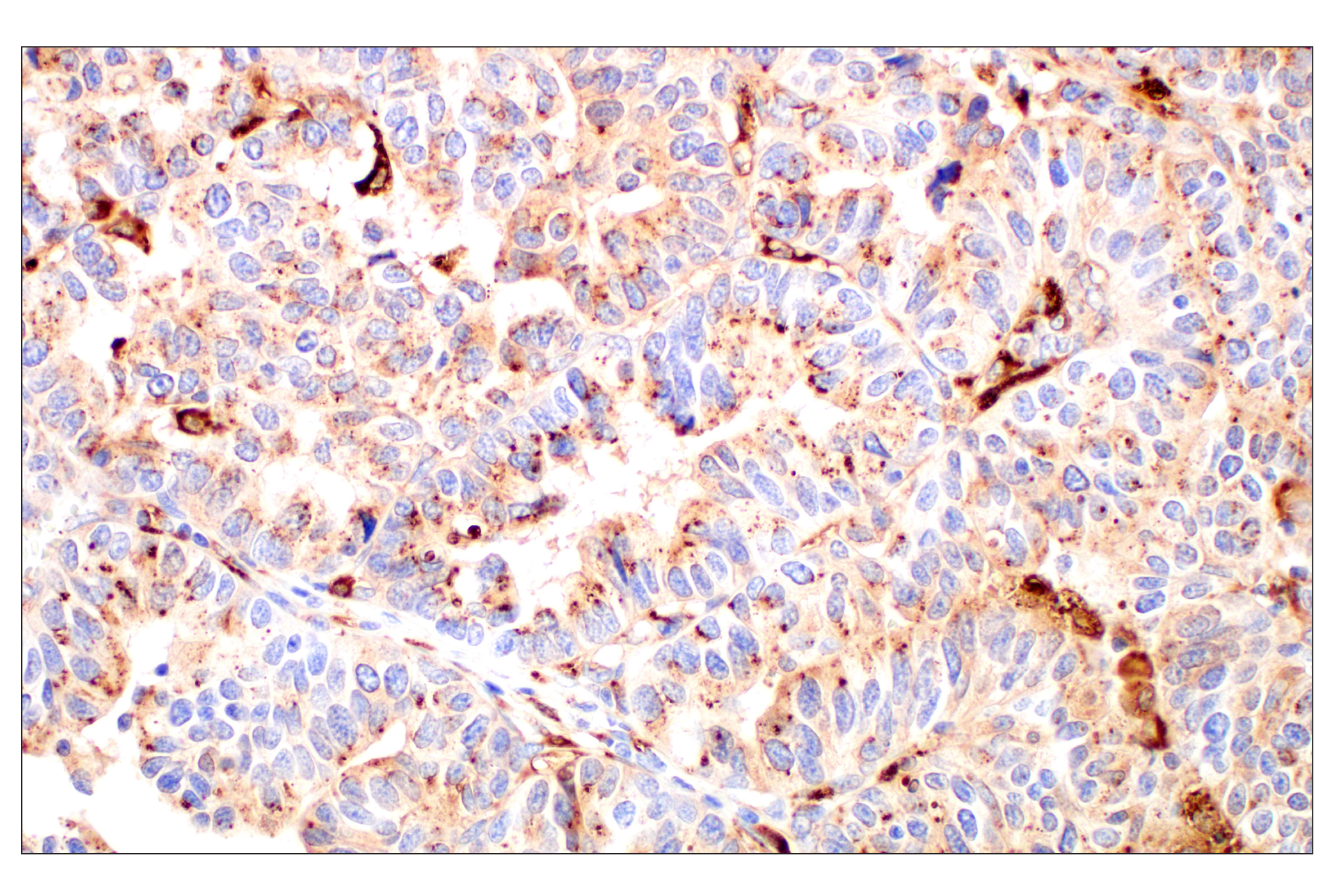 Immunohistochemistry Image 1: Cathepsin L (E3R3P) Rabbit mAb