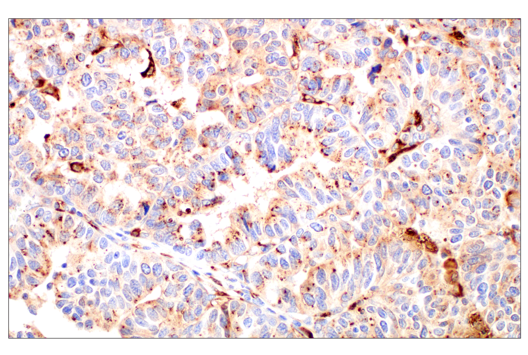 Immunohistochemistry Image 2: Cathepsin L (E3R3P) Rabbit mAb