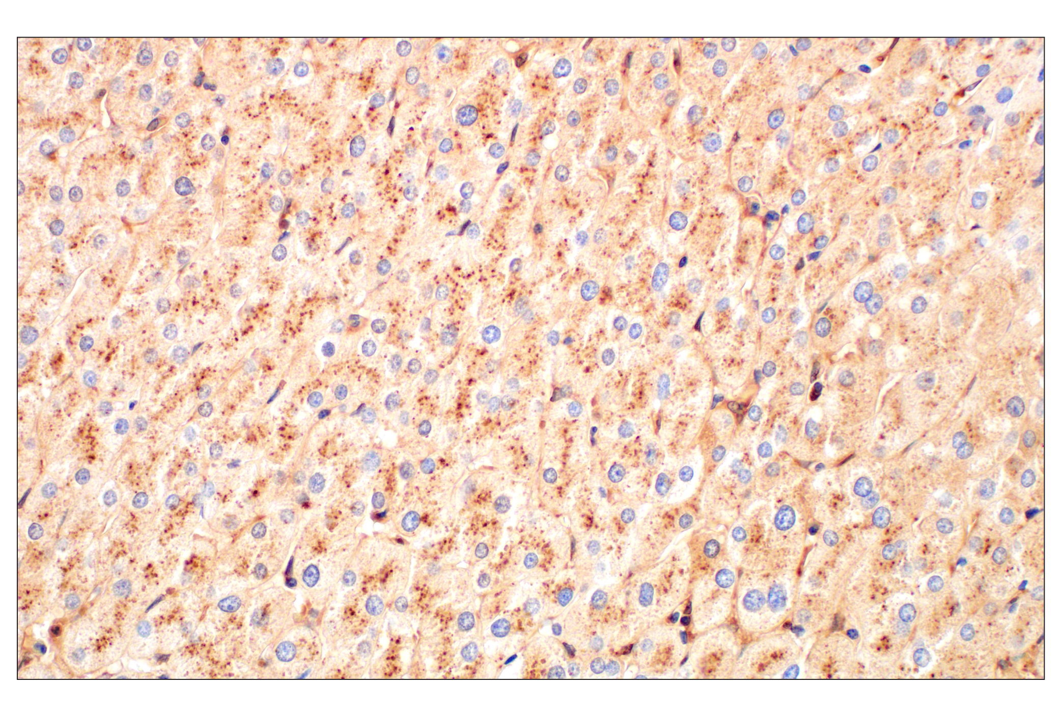 Immunohistochemistry Image 10: Cathepsin L (E3R3P) Rabbit mAb