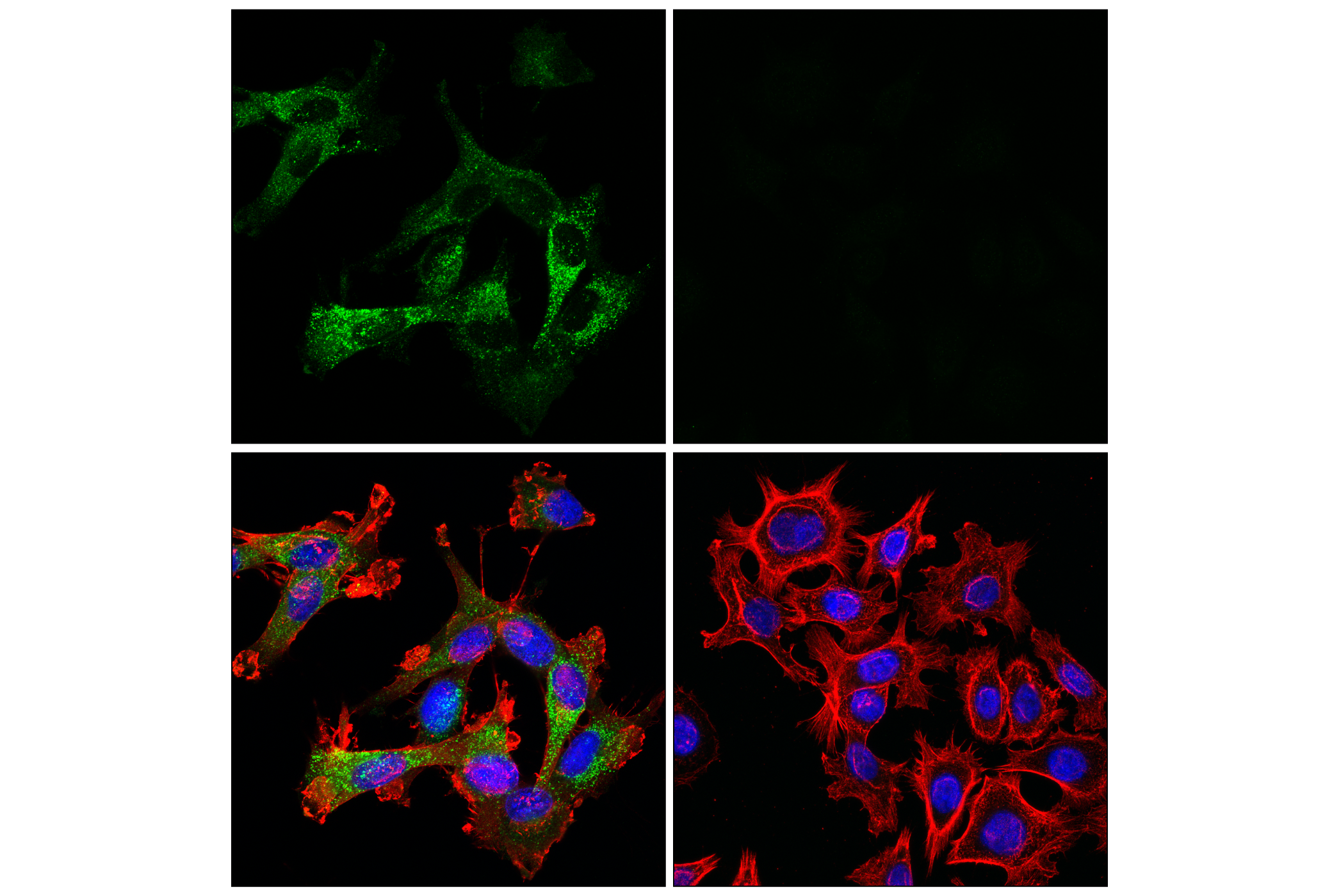 Immunofluorescence Image 2: Cathepsin L (E3R3P) Rabbit mAb